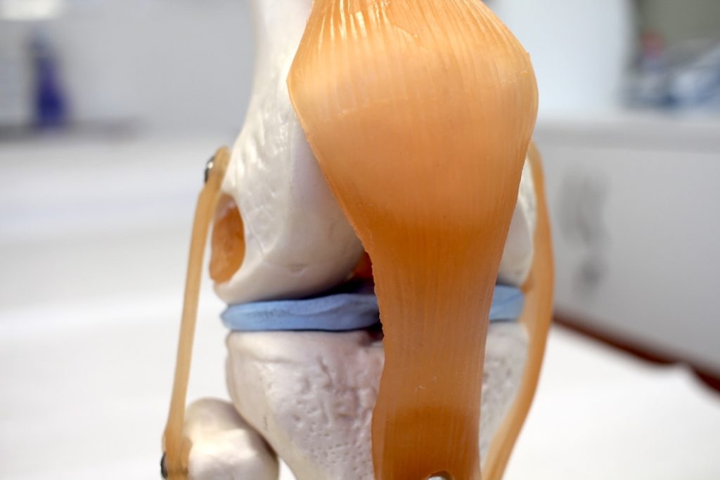 runner knee