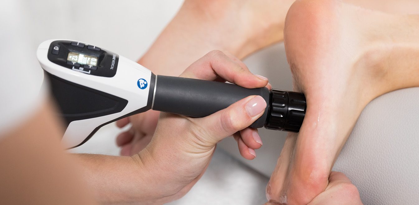 SHOCKWAVE therapy FOR PLANTAR fasciitis AND HEEL PAIN