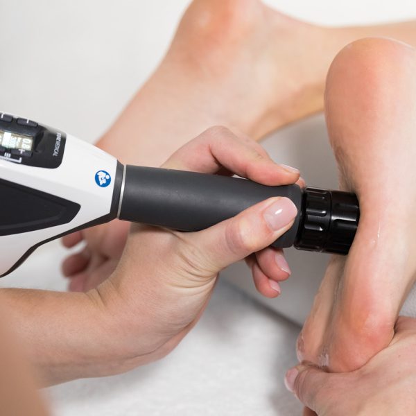SHOCKWAVE therapy FOR PLANTAR fasciitis AND HEEL PAIN