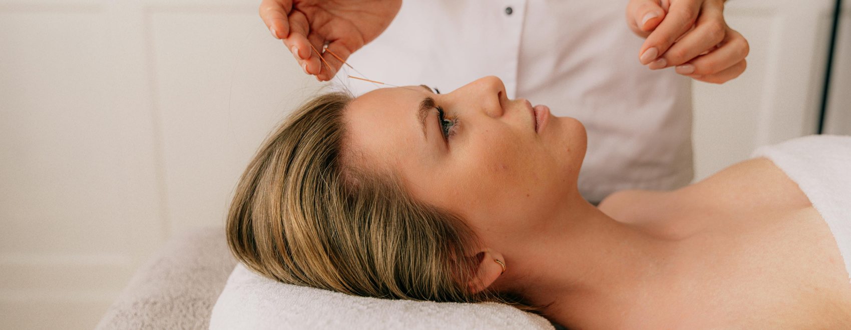 Acupuncture for stress and anxiwty