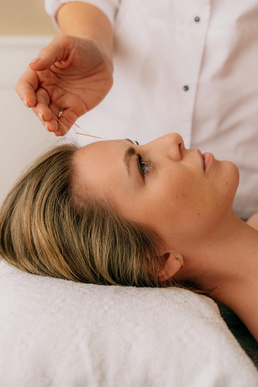 Acupuncture for stress and anxiwty