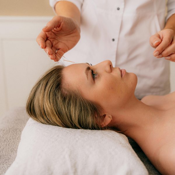 Acupuncture for stress and anxiwty